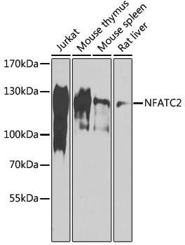 NFATC2 Polyclonal Antibody (E-AB-90750)