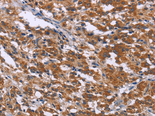 SKI Polyclonal Antibody (E-AB-17307)