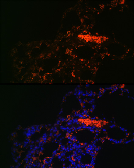 ABCG1 Polyclonal Antibody (E-AB-67613)