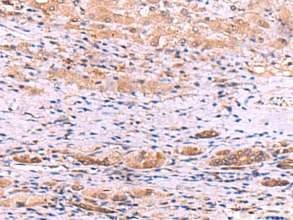 DHPS Polyclonal Antibody (E-AB-52914)