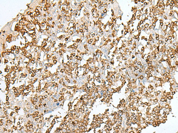 SEPT1 Polyclonal Antibody (E-AB-18820)