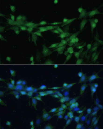 CSNK2B Polyclonal Antibody (E-AB-66333)