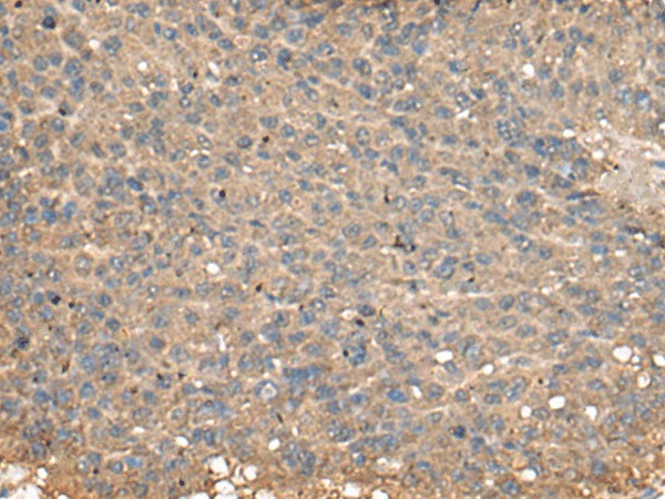 PLA2G2A Polyclonal Antibody (E-AB-53043)