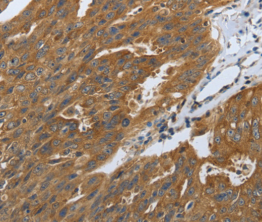 DLG4 Polyclonal Antibody (E-AB-16042)