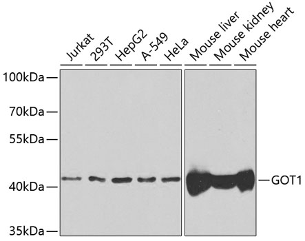 GOT1 Polyclonal Antibody (E-AB-61133)