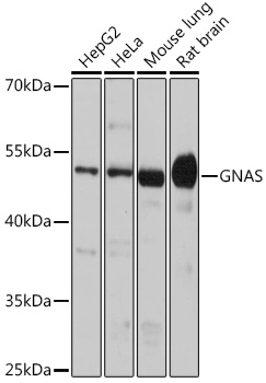 GNAS Polyclonal Antibody (E-AB-61003)