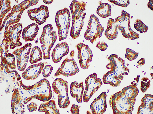 TG Monoclonal Antibody (ELAB6654-M)