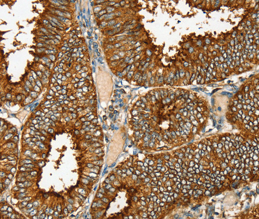 RAB25 Polyclonal Antibody (E-AB-11512)