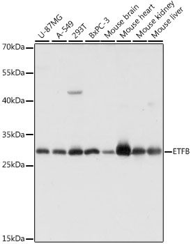 ETFB Polyclonal Antibody (E-AB-66665)