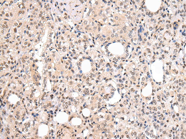 CBX7 Polyclonal Antibody (E-AB-17698)