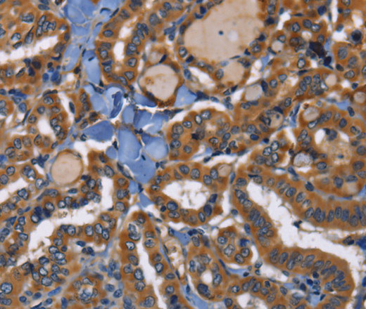 EPHB6 Polyclonal Antibody (E-AB-14687)