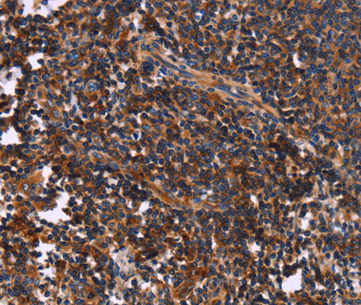 SYT4 Polyclonal Antibody (E-AB-10617)