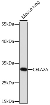 CELA2A Polyclonal Antibody (E-AB-91728)