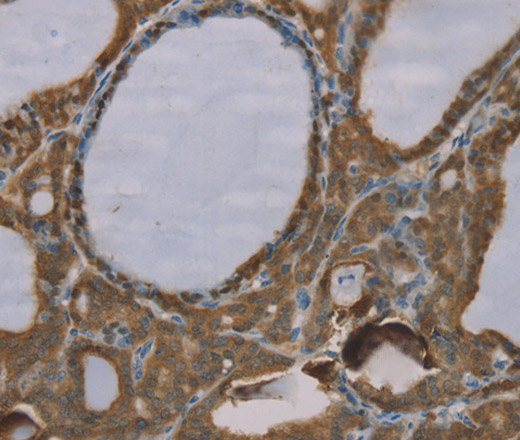S100A6 Polyclonal Antibody (E-AB-13586)