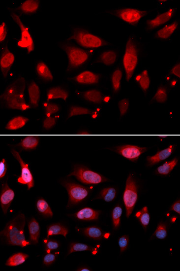 RACGAP1 Polyclonal Antibody (E-AB-60879)