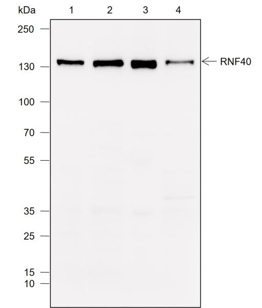 Recombinant RNF40 Monoclonal Antibody (AN302055L)