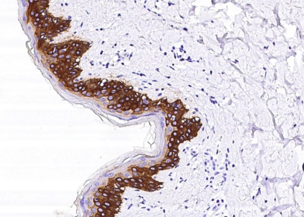 Recombinant KRT14/Cytokeratin 14 Monoclonal Antibody (AN300289P)