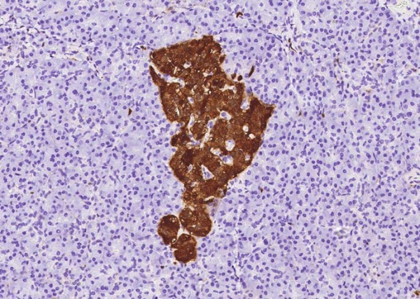 ENO2 Monoclonal Antibody (AN200228P)