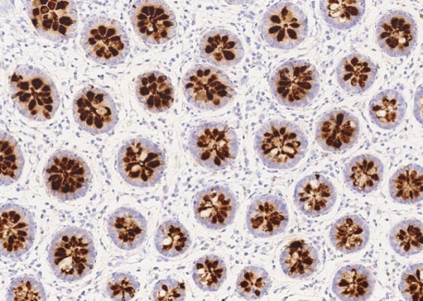 Recombinant REG4 Monoclonal Antibody (AN300226P)