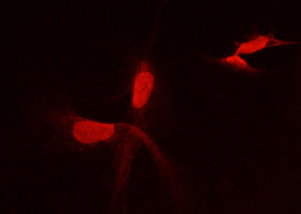 PFDN2 Monoclonal Antibody (AN200241P)