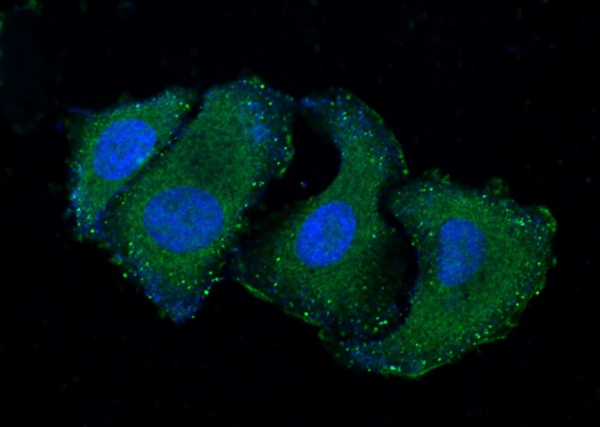 RELT/TNFRSF19L Monoclonal Antibody (AN200179P)