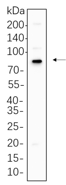 Recombinant p63 Monoclonal Antibody (AN300715L)