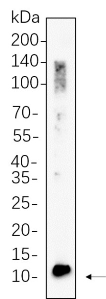Recombinant BDNF Monoclonal Antibody (AN300600L)