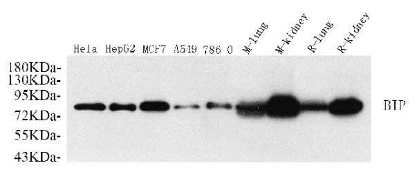 HSPA5 Polyclonal Antibody (E-AB-70042)