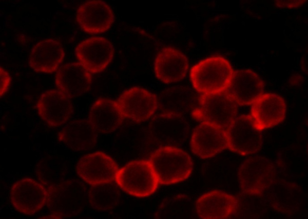 Recombinant CD62L/L-Selectin Monoclonal Antibody (AN300465P)