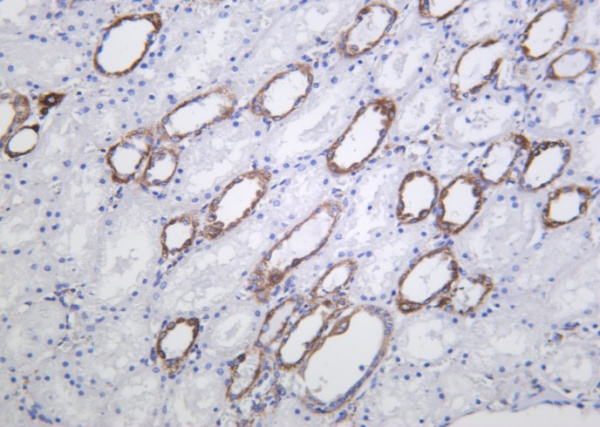 Recombinant HXK I Monoclonal Antibody (AN301256L)