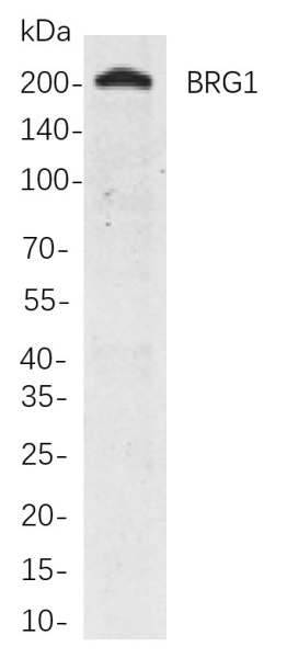 Recombinant BRG1 Monoclonal Antibody (AN300890L)