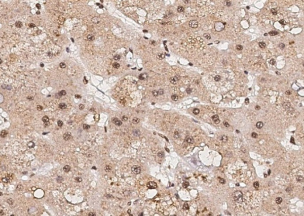 RPRD1B Monoclonal Antibody (AN200141P)