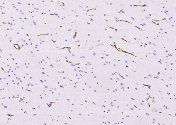 Nestin/NES Monoclonal Antibody (AN200172P)