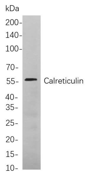 Recombinant Calreticulin Monoclonal Antibody (AN301032L)