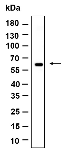 Recombinant Cytokeratin 10 Monoclonal Antibody (AN301158L)