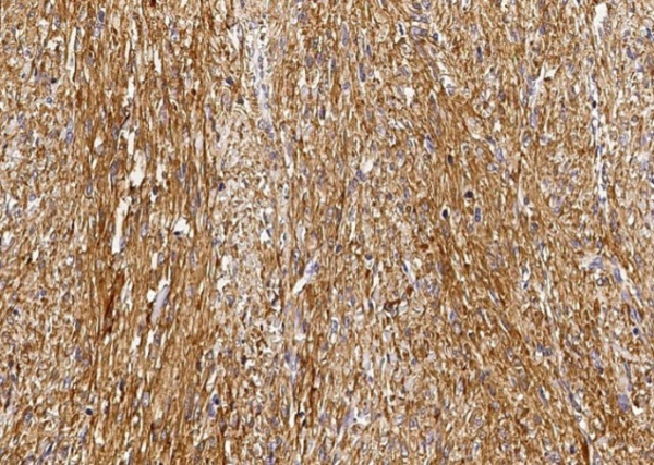 Recombinant GSTM2 Monoclonal Antibody (AN300246P)