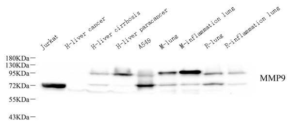 MMP9 Monoclonal Antibody (E-AB-70247)