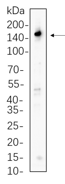 Recombinant PLC γ1 Monoclonal Antibody (AN300669L)