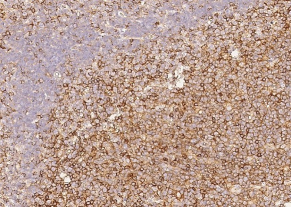 Recombinant LFA-3/CD58 Monoclonal Antibody (AN300252P)