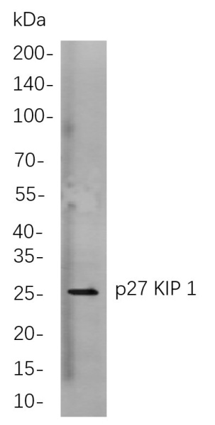Recombinant p27 KIP 1 Monoclonal Antibody (AN301021L)