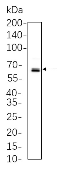 Recombinant Phospho-NF-κB p65 (Ser536) Monoclonal Antibody (AN301332L)