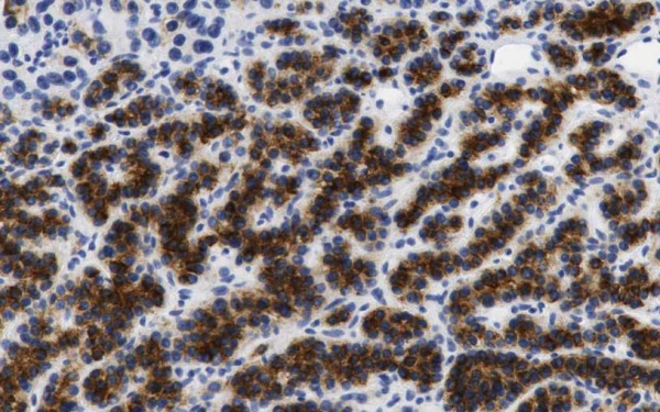 PTH Monoclonal Antibody (ELAB6471-M)