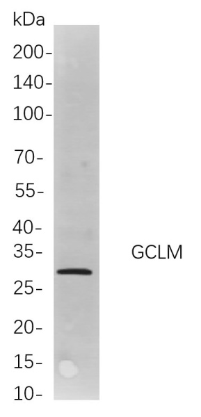 Recombinant GCLM Monoclonal Antibody (AN301022L)