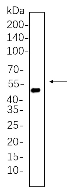 Recombinant Cytokeratin 20 Monoclonal Antibody (AN300626L)