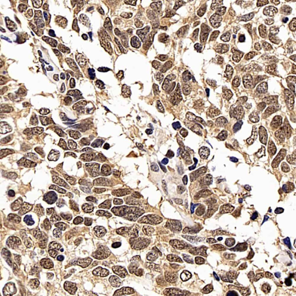 p27 Polyclonal Antibody (E-AB-70069)