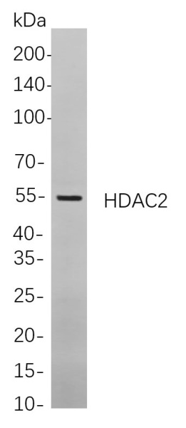 Recombinant HDAC2 Monoclonal Antibody (AN301079L)