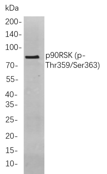 Recombinant Phospho-p90RSK（Thr359, Ser363) Monoclonal Antibody (AN300870L)