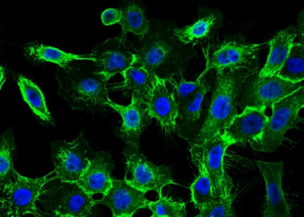 Recombinant EGFR/HER1/ErbB1 Monoclonal Antibody (AN300008P)