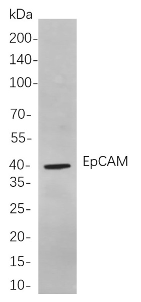 Recombinant EpCAM Monoclonal Antibody (AN300999L)