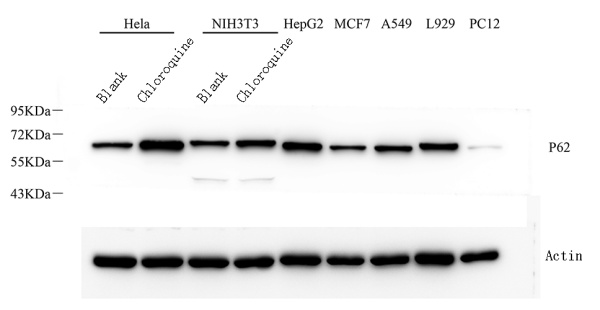 P62/SQSTM1 Polyclonal Antibody (E-AB-70387)